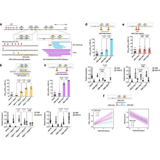 Hereditary Persistence of Fetal Hemoglobin (HPFH )- 5 Deletions